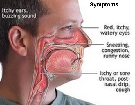 A symptoms infograph.