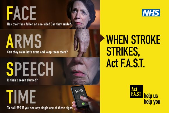 Infograph for Act F.A.S.T (Face, Arms, Speech, Time) campaign that tells you the symptoms of a stroke.